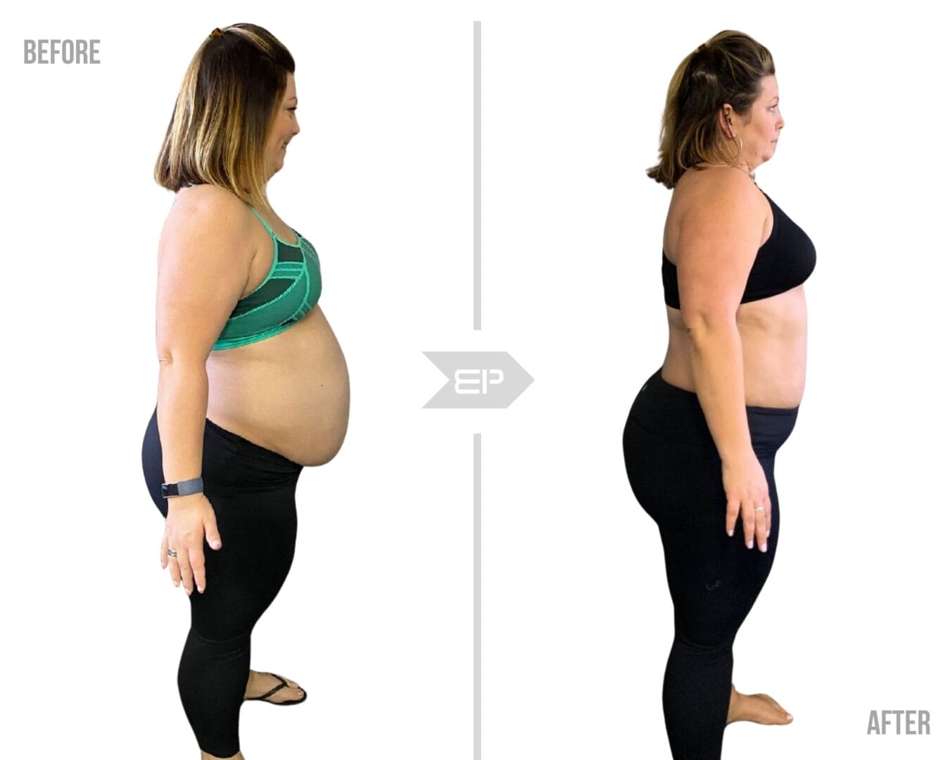 Woman before and after results image