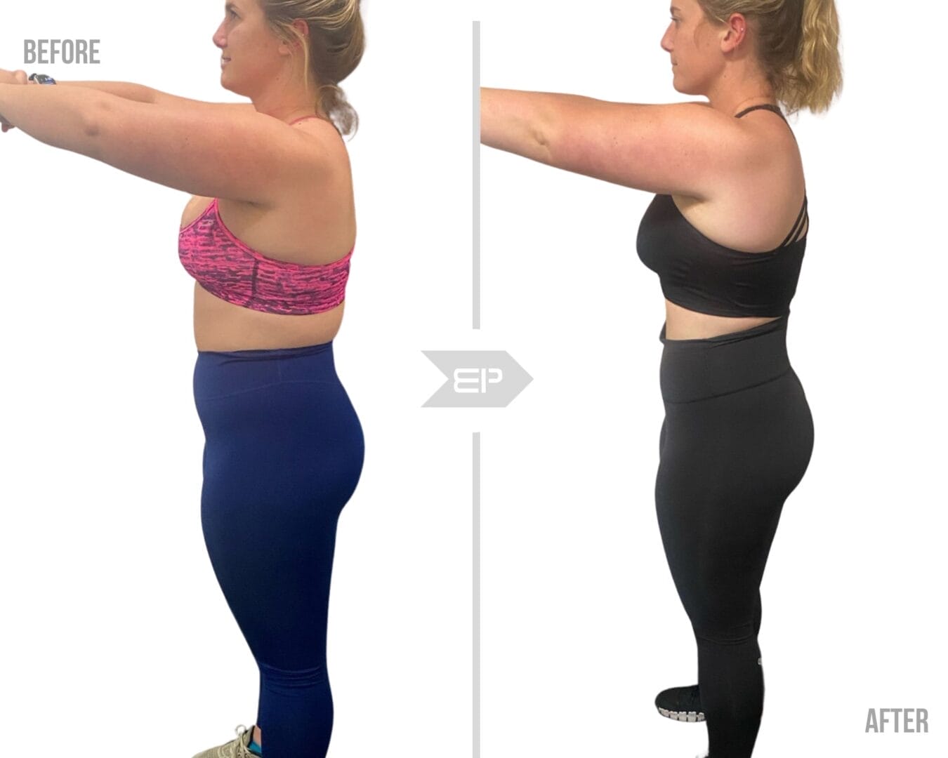 Woman before and after results image