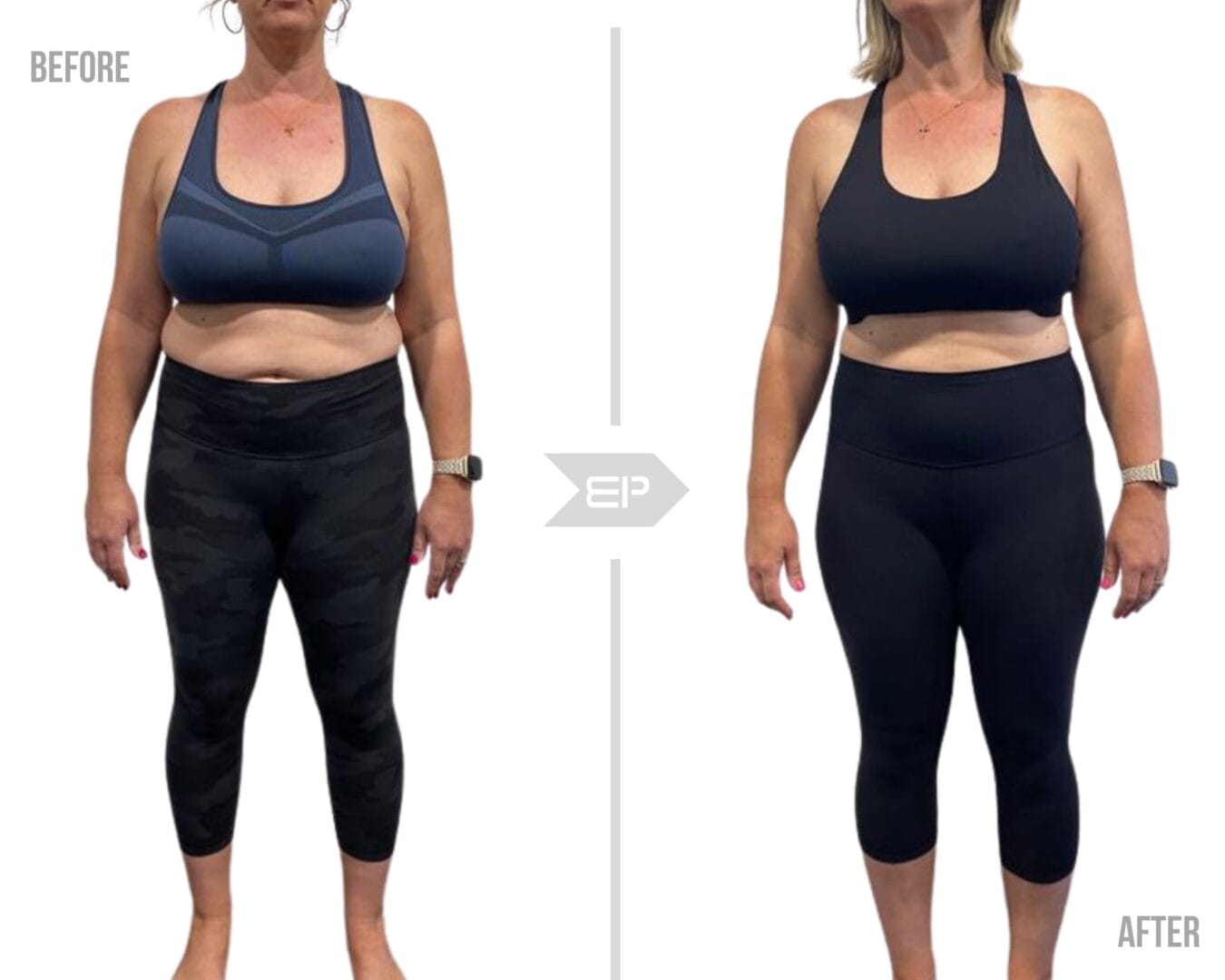 Before and after woman body picture