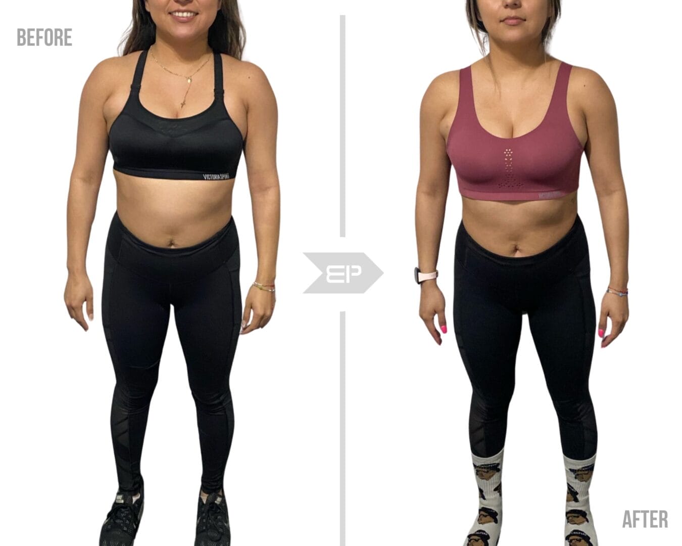 Woman before and after results