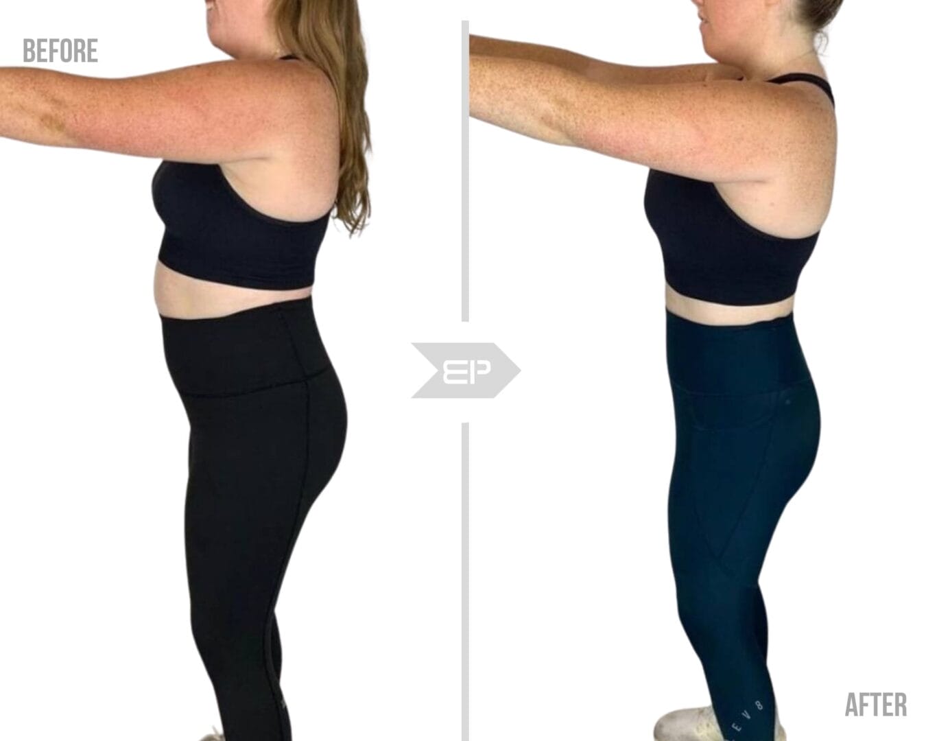 Woman before and after results