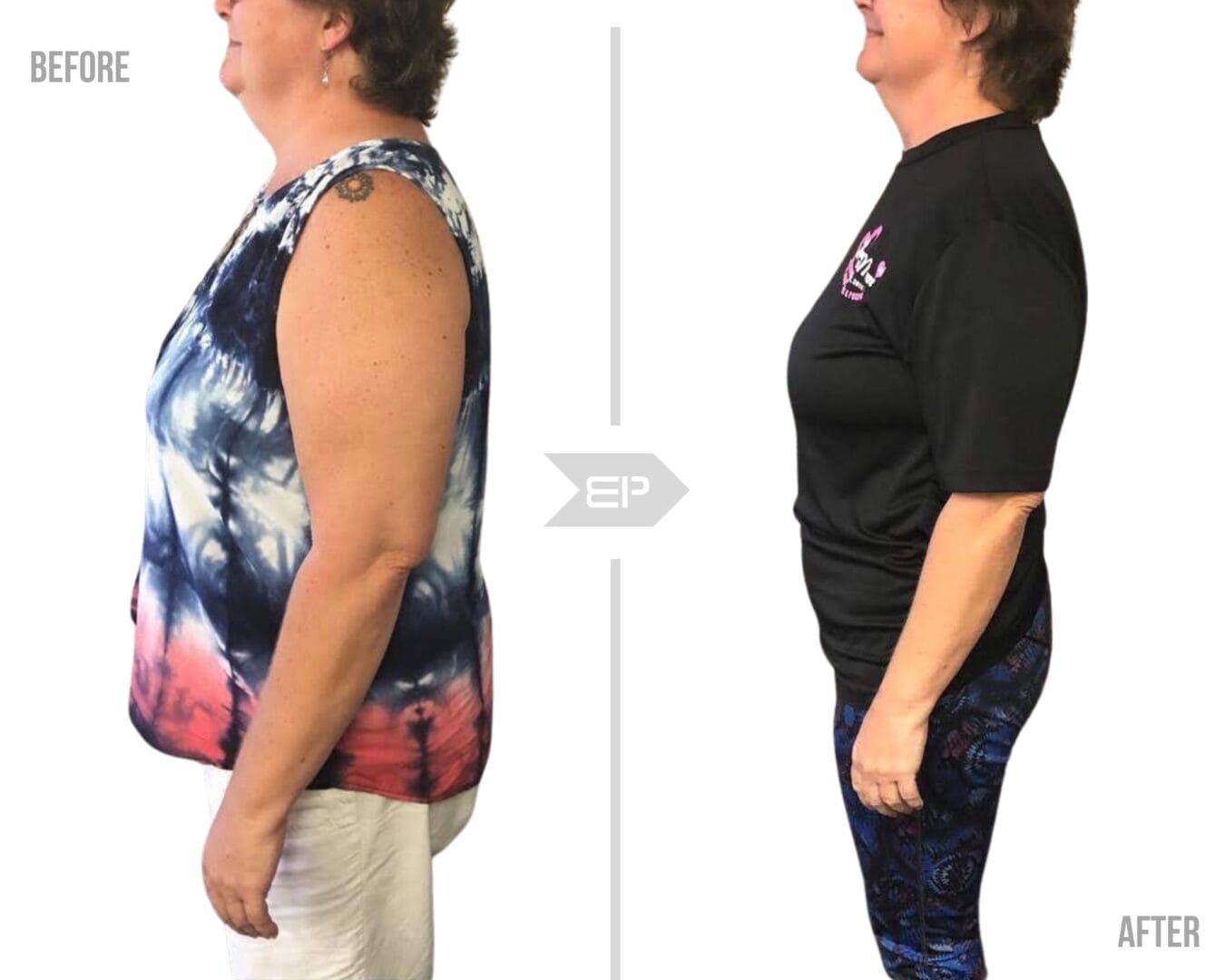 Woman before and after results